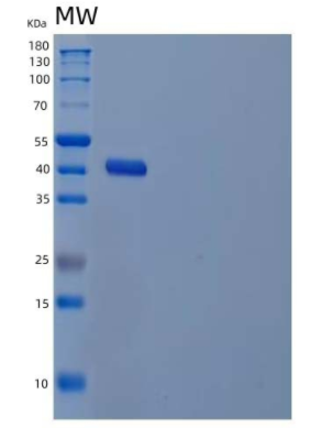 Recombinant Human UDP-Glucose 4-Epimerase/GALE Protein(N-6His),Recombinant Human UDP-Glucose 4-Epimerase/GALE Protein(N-6His)