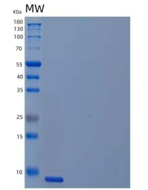 Recombinant Human Unique Cartilage Matrix-Associated Protein/UCMA Protein,Recombinant Human Unique Cartilage Matrix-Associated Protein/UCMA Protein