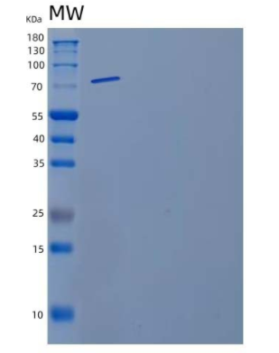 Recombinant Mouse Matrix Metalloproteinase-9/MMP-9 Protein,Recombinant Mouse Matrix Metalloproteinase-9/MMP-9 Protein