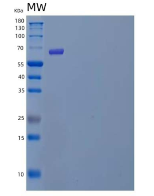 Recombinant Human POMGNT1 Protein(C-6His),Recombinant Human POMGNT1 Protein(C-6His)