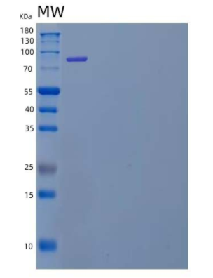 Recombinant Human Dipeptidyl-Peptidase 3/DPP3 Protein(N-6His),Recombinant Human Dipeptidyl-Peptidase 3/DPP3 Protein(N-6His)