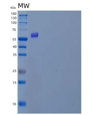 Recombinant Human Polypeptide GalNac Transferase 3/GALNT3 Protein(C-6His),Recombinant Human Polypeptide GalNac Transferase 3/GALNT3 Protein(C-6His)