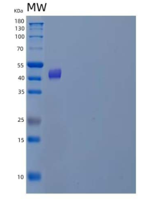 Recombinant Human Uroporphyrinogen Decarboxylase/UROD Protein(N-6His),Recombinant Human Uroporphyrinogen Decarboxylase/UROD Protein(N-6His)