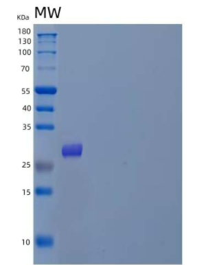 Recombinant Mouse Myostatin/MSTN/GDF-8 Protein(C-6His),Recombinant Mouse Myostatin/MSTN/GDF-8 Protein(C-6His)