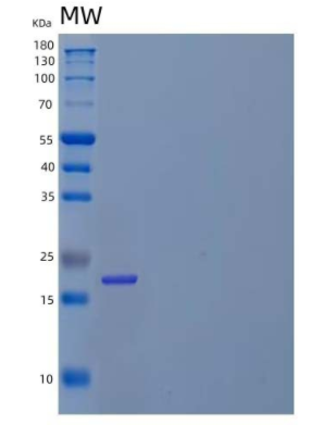 Recombinant Human PRADC1/PAP21 Protein(C-6His),Recombinant Human PRADC1/PAP21 Protein(C-6His)