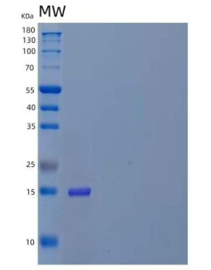 Recombinant Human Amyloid β A4 Precursor Protein-Binding A3/APBA3/X11-γ Protein(C-6His),Recombinant Human Amyloid β A4 Precursor Protein-Binding A3/APBA3/X11-γ Protein(C-6His)