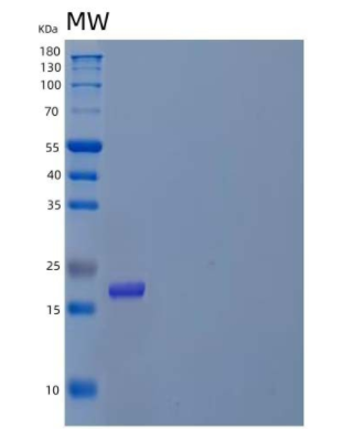 Recombinant Human Prefoldin Subunit 2/PFDN2 Protein(N-6His),Recombinant Human Prefoldin Subunit 2/PFDN2 Protein(N-6His)