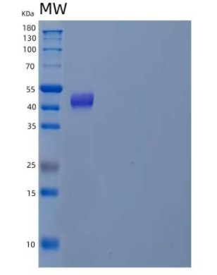 Recombinant Human DNA Polymerase δ Subunit 2/POLD2 Protein(C-6His),Recombinant Human DNA Polymerase δ Subunit 2/POLD2 Protein(C-6His)