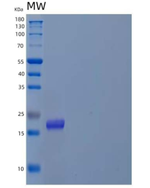 Recombinant Human Prefoldin Subunit 4/PFDN4 Protein(N-6His),Recombinant Human Prefoldin Subunit 4/PFDN4 Protein(N-6His)