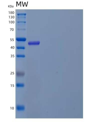 Recombinant Human Angiopoietin-Like Protein 8/ANGPTL8/βtrophin Protein(N-Fc),Recombinant Human Angiopoietin-Like Protein 8/ANGPTL8/βtrophin Protein(N-Fc)