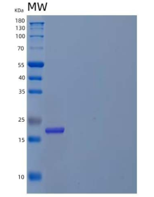 Recombinant Human D-Tyrosyl-tRNA Protein,Recombinant Human D-Tyrosyl-tRNA Protein