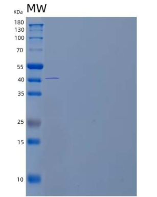 Recombinant Human Pregnancy-Specific β-1-Glycoprotein 3/PSG3 Protein(C-6His),Recombinant Human Pregnancy-Specific β-1-Glycoprotein 3/PSG3 Protein(C-6His)