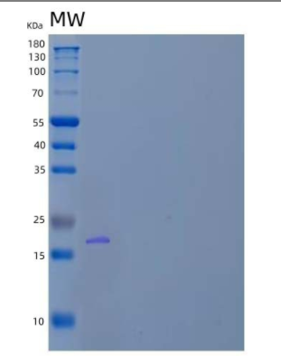 Recombinant Human dUTP Pyrophosphatase/dUTPase Protein,Recombinant Human dUTP Pyrophosphatase/dUTPase Protein