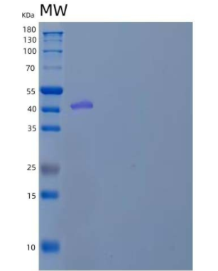 Recombinant Mouse Plasminogen Activator Inhibitor 1/PAI-1/SERPIN E1 Protein(C-6His),Recombinant Mouse Plasminogen Activator Inhibitor 1/PAI-1/SERPIN E1 Protein(C-6His)