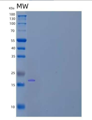 Recombinant Human Early Placenta Insulin-Like Peptide/INSL4/Placentin Protein(C-6His),Recombinant Human Early Placenta Insulin-Like Peptide/INSL4/Placentin Protein(C-6His)