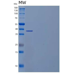 Recombinant Human Inhibin β C Chain/INHBC Protein(C-6His),Recombinant Human Inhibin β C Chain/INHBC Protein(C-6His)