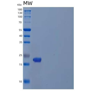 Recombinant Human PDGF-Associated Protein/PAP Protein(N-6His)