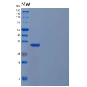 Recombinant Human Inositol Monophosphatase 1/IMPA1/IIMPase 2 Protein(N-6His)