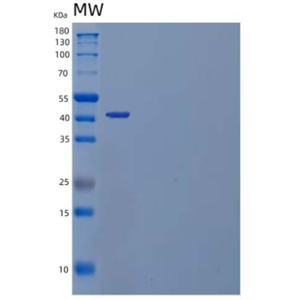 Recombinant Human Inositol Polyphosphate 1-Phosphatase/INPP1 Protein(C-6His)