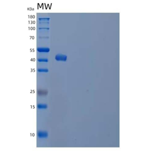 Recombinant Human Serine Protease Inhibitor-clade B3 Protein