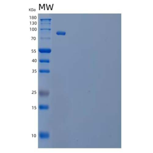 Recombinant Human Phosphatidylinositol 4-Kinase β/PI4KB Protein(C-6His)