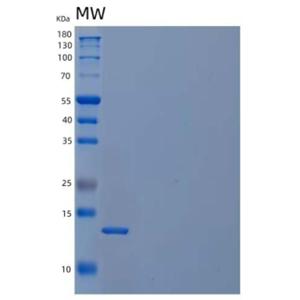 Recombinant Human Cystatin C/CST3 Protein(C-6His)