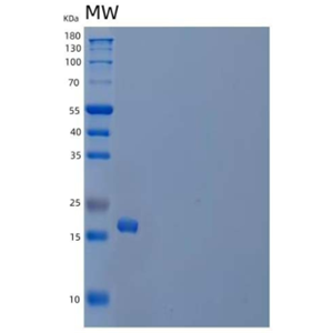 Recombinant Human Ganglioside GM2 activator Protein