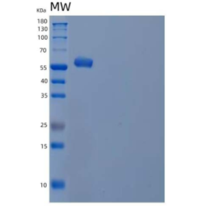 Recombinant Human Interferon Regulatory Factor 5/IRF5 Protein(C-6His)