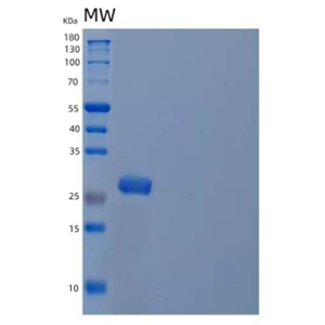 Recombinant Human Peroxiredoxin-6/PRDX6 Protein(N-6His)