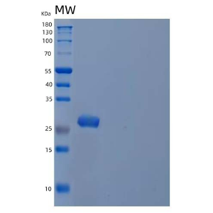 Recombinant Human Peroxiredoxin-6/PRDX6 Protein(N-6His),Recombinant Human Peroxiredoxin-6/PRDX6 Protein(N-6His)