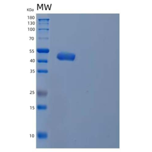 Recombinant Human Type I Inositol 1,4,5-Trisphosphate 5-Phosphatase/INPP5A Protein(C-6His)