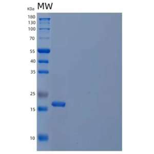 Recombinant Mouse Interleukin-1β/IL-1β Protein,Recombinant Mouse Interleukin-1β/IL-1β Protein