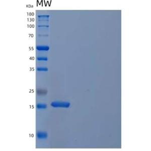 Recombinant Human Cystatin S/CST4 Protein(C-6His)