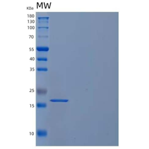 Recombinant Human U6 snRNA-Associated Sm-Like Protein LSm1/LSM1 Protein(C-6His)