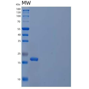 Recombinant Human Cystatin F/CST7 Protein(C-6His)