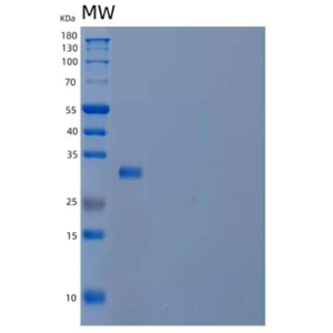 Recombinant Human Cysteine-Rich with EGF-Like Domain Protein 2/CRELD2 Protein(C-6His)