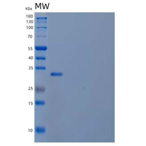 Recombinant Human Activating Transcription Factor 1/ATF1 Protein(C-6His)