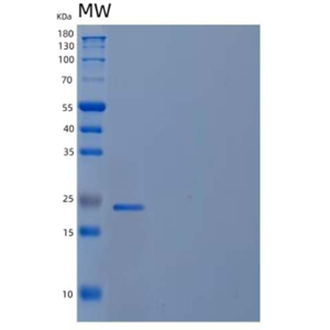 Recombinant Human Phosphomevalonate Kinase/PMVK Protein(N-6His)