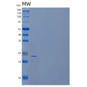 Recombinant Human Phosphopantothenoylcysteine Decarboxylase/PPC-DC Protein(N-6His)