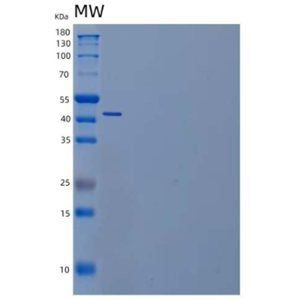 Recombinant Human Interleukin-17A/F Heterodimer/IL-17A & IL-17F Protein(C-6His)