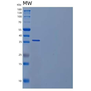 Recombinant Mouse L-Lactate Dehydrogenase/LDHA/LDH1 Protein(C-6His)