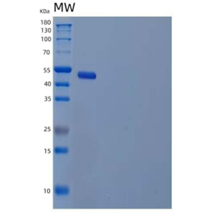 Recombinant Human Airway Trypsin-Like Protease 5/HATL5/TMPRSS11B Protein(C-6His)