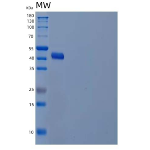 Recombinant Human Alcohol Dehydrogenase Class 4 Mu/ADH7 Protein(C-6His)
