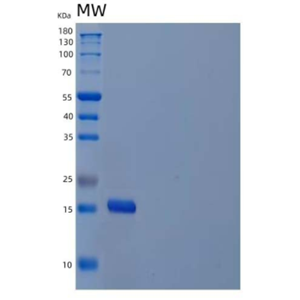 Recombinant Human Interleukin-21/IL-21 Protein