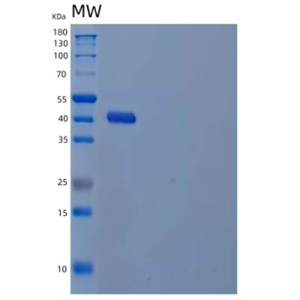 Recombinant Human UDP-Glucose 4-Epimerase/GALE Protein(N-6His)