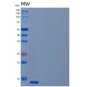 Recombinant Human Unique Cartilage Matrix-Associated Protein/UCMA Protein,Recombinant Human Unique Cartilage Matrix-Associated Protein/UCMA Protein