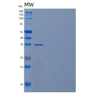 Recombinant Human Poliovirus Receptor-Related Protein 1/PVRL1 Protein(C-6His)