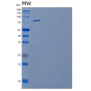 Recombinant Mouse Matrix Metalloproteinase-9/MMP-9 Protein,Recombinant Mouse Matrix Metalloproteinase-9/MMP-9 Protein