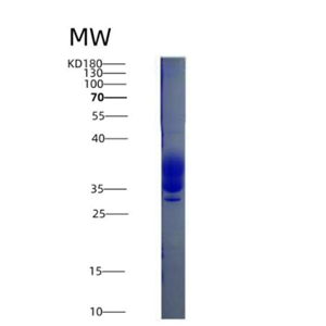 Eukaryotic Colony Stimulating Factor 1, Macrophage (MCSF)