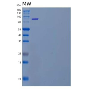 Recombinant Human Dipeptidyl-Peptidase 3/DPP3 Protein(N-6His)